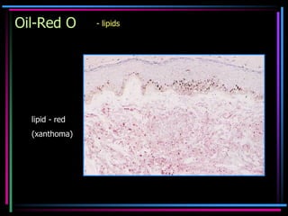 1. Histology of normal skin and Inflammatory cells- MG.pdf