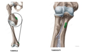 1. General Anatomy of Bones.pptx Types of bones , Classification | PPTX