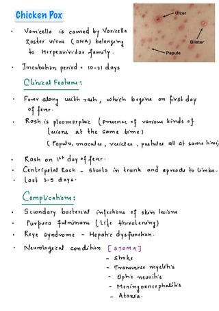 1. Viral Diseases.measlfs mumps and other pdf | PDF