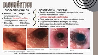 1.4 Esofagitis no peptica e infecciosa E | PDF