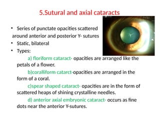 1.CATARACT INTRODUCTION AND DEVELOPMENTAL CATARACT.pptx