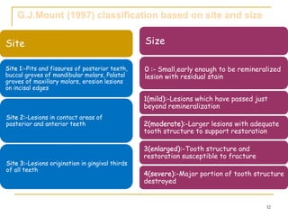 Mount Home Classification System Comprehensive Overview of Dental Caries: Definitions, Classification ...