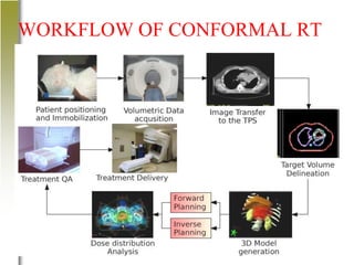 Advancements in Conformal Radiation Therapy Techniques and IGRT | PDF