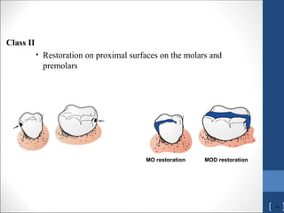 Mod Teeth Comprehensive Principles and Techniques of Tooth Preparation in ...