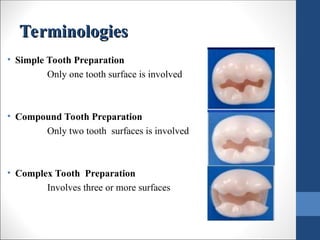 Compound Tooth Comprehensive Principles and Techniques of Tooth Preparation in ...