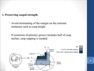 Cuspal Protection Comprehensive Principles and Techniques of Tooth Preparation in ...