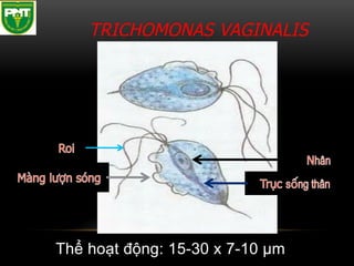 comprehensive-overview-of-trichomonas-vaginalis-identification