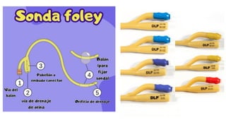 Comprehensive Guide to Foley Catheterization: Indications, Types, and ...