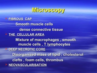 Comprehensive Overview of Cardiovascular Diseases and Atherosclerosis ...