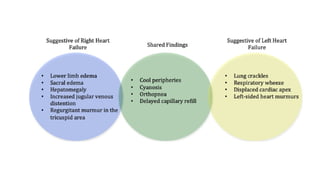 Comprehensive Overview of Heart Failure and Cardiogenic Shock ...
