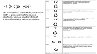 Ridge Classification and Neutral Zone Technique in Prosthodontics | PPTX