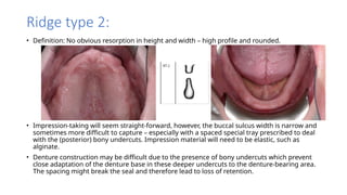 Ridge Classification and Neutral Zone Technique in Prosthodontics | PPTX