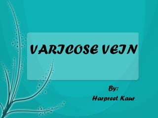 VARICOSE VEIN
By:
Harpreet Kaur
 