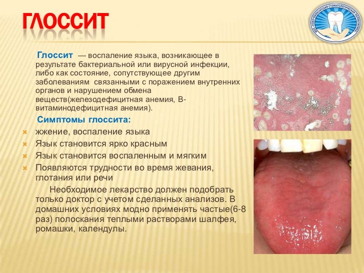 Слизистая рта нормальный цвет Слизистая рта нормальный цвет