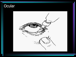 Ocular
 