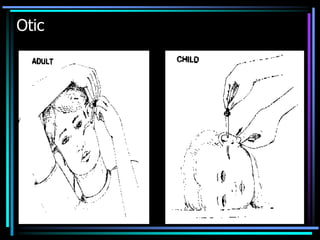 Otic
 