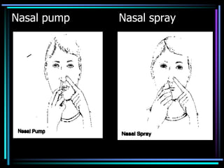 Nasal pump Nasal spray
 