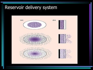 Reservoir delivery system
 