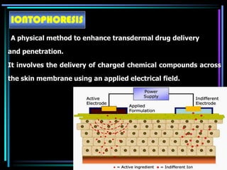 IONTOPHORESIS
A physical method to enhance transdermal drug delivery
and penetration.
It involves the delivery of charged chemical compounds across
the skin membrane using an applied electrical field.
 