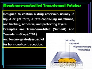 Designed to contain a drug reservoir, usually in
liquid or gel form, a rate-controlling membrane,
and backing, adhesive, and protecting layers.
Examples are Transderm-Nitro (Summit) and
Transderm-Scop (CIBA)
and levonorgestrel/estradiol
for hormonal contraception.
Membrane-controlled Transdermal Patches
 