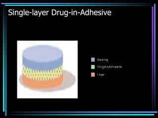 Single-layer Drug-in-Adhesive
 