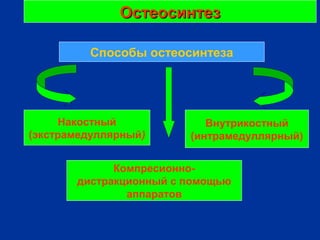 ОстеосинтезОстеосинтез
Способы остеосинтеза
Накостный
(экстрамедуллярный)
Внутрикостный
(интрамедуллярный)
Компресионно-
дистракционный с помощью
аппаратов
 
