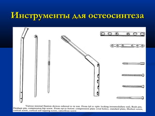 Инструменты для остеосинтезаИнструменты для остеосинтеза
 