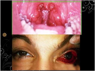 1.4 the harmful effects of microorganism