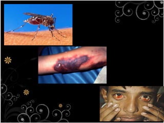 Rash 