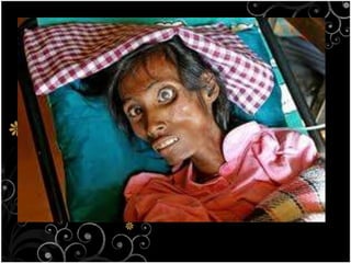 Until now, still no medicine to cure medicine.Treatment usually include controlling the symptoms such as reducing the fever.Drinks lots of fluid and getting plenty of rest are needed too