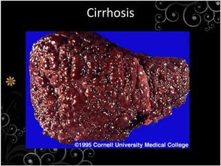 1.4 the harmful effects of microorganism