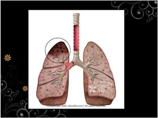 1.4 the harmful effects of microorganism