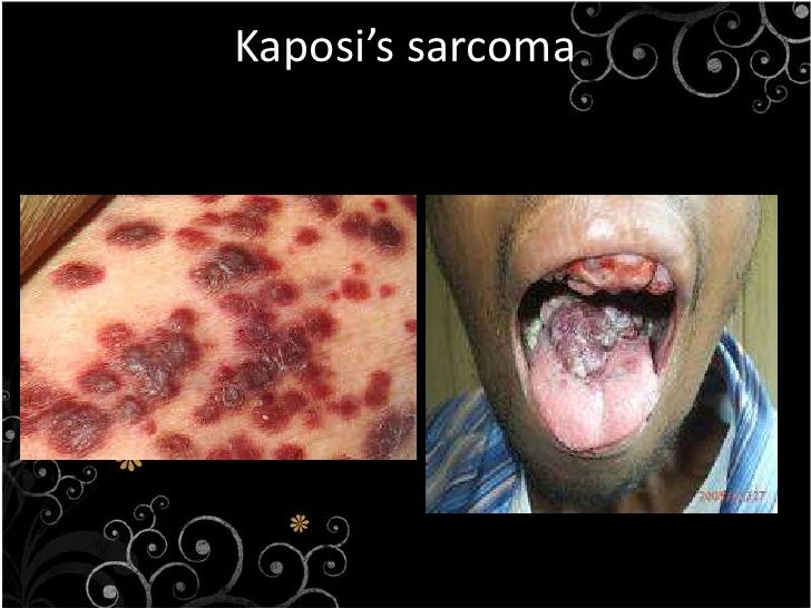egg jaundice in effects 1.4 microorganism of the harmful