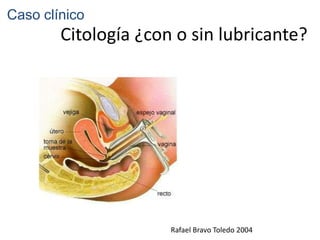 Caso clínico
        Citología ¿con o sin lubricante?




                      Rafael Bravo Toledo 2004
 
