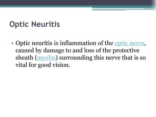 Optic Neuritis
• Optic neuritis is inflammation of the optic nerve,
caused by damage to and loss of the protective
sheath (myelin) surrounding this nerve that is so
vital for good vision.
 