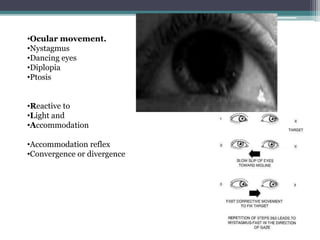 •Ocular movement.
•Nystagmus
•Dancing eyes
•Diplopia
•Ptosis
•Reactive to
•Light and
•Accommodation
•Accommodation reflex
•Convergence or divergence
 