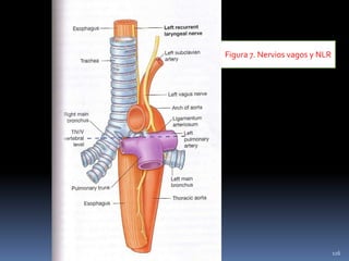 Figura 7. Nervios vagos y NLR
116
 