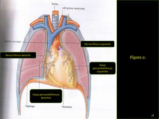 Figura 2.
Nervio frénico derecho
Nervio frénico izquierdo
Vasos pericardiofrénicos
derechos
Vasos
pericardiofrénicos
izquierdos
18
 