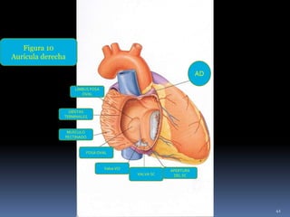 Figura 10
Aurícula derecha
AD
FOSA OVAL
LIMBUS FOSA
OVAL
CRISTAS
TERMINALES
MUSCULO
PECTINADO
Valva VCI
VALVA SC
APERTURA
DEL SC
41
 