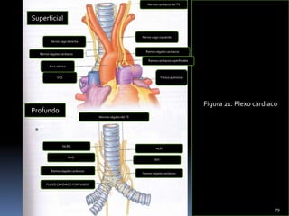 Figura 21. Plexo cardiaco
Nervios cardiacos del TS
Nervio vago izquierdo
Ramos vágales cardiacos
Ramos cardiacos superficiales
Tronco pulmonar
Nervio vago derecho
Ramos vágales cardiacos
Arco aórtico
VCS
Superficial
Profundo
Nervios vágales del TS
NLRD
NVD
Ramos vágales cardiacos
PLEXO CARDIACO PORFUNDO
NLRI
NVI
Ramos vágales cardiacos
79
 