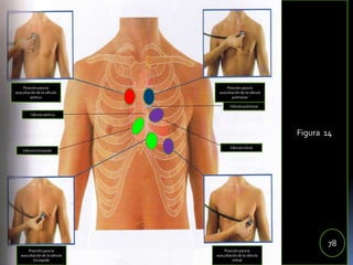 84
Figura 14
78
Posición para la
auscultación de la válvula
aortica
Posición para la
auscultación de la válvula
pulmonar
Posición para la
auscultación de la válvula
tricúspide
Posición para la
auscultación de la válvula
mitral
Válvula aórtica
Válvula pulmonar
Válvula tricúspide
Válvula mitral
 