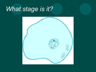 What stage is it? 