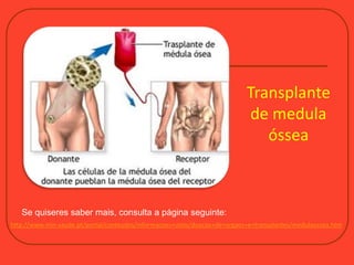 http://www.min-saude.pt/portal/conteudos/informacoes+uteis/doacao+de+orgaos+e+transplantes/medulaossea.htm
Se quiseres saber mais, consulta a página seguinte:
Transplante
de medula
óssea
 
