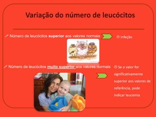 Variação do número de leucócitos
 Número de leucócitos superior aos valores normais
 Número de leucócitos muito superior aos valores normais
 Infeção
 Se o valor for
significativamente
superior aos valores de
referência, pode
indicar leucemia
 