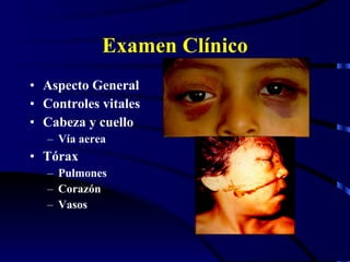 Examen Clínico Aspecto General Controles vitales Cabeza y cuello Vía aerea Tórax Pulmones Corazón Vasos  