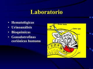 Laboratorio Hematológicas Urinoanálisis Bioquímicas Gonadotrofinas coriónicas humana 