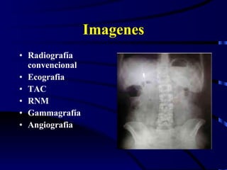 Imagenes Radiografía convencional Ecografia TAC RNM Gammagrafía Angiografia 