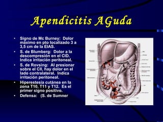 Apendicitis AGuda Signo de Mc Burney:  Dolor máximo en pto localizado 3 a 3,5 cm de la EIAS. S. de Blumberg:  Dolor a la descompresión en el CID.  Indica irritación peritoneal.  S. de Rovsing:  Al presionar sobre el CII, hay dolor en el lado contralateral.  Indica irritación peritoneal.  Hiperestesia cutánea en la zona T10, T11 y T12.  Es el primer signo positivo.  Defensa:  (S. de Sumner 