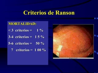 Criterios de Ranson MORTALIDAD: < 3  criterios =  1 % 3-4  criterios =  1 5 % 5-6  criterios =  50 % 7  criterios =  1 00 % 