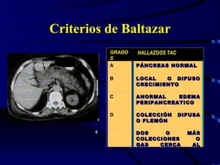Criterios de Baltazar GRADOS HALLAZGOS TAC A PÁNCREAS NORMAL B LOCAL  O DIFUSO CRECIMIENTO C ANORMAL EDEMA PERIPANCREATICO D COLECCIÓN DIFUSA O FLEMÓN   E DOS O MÁS COLECCIONES O GAS CERCA AL PÁNCREAS . 